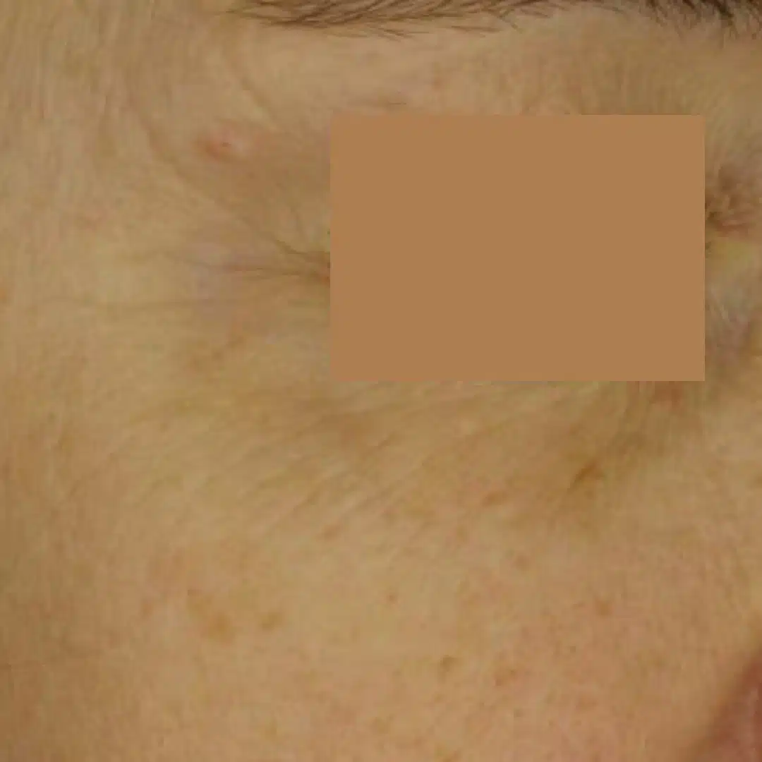Concentrate Moisturizer: after, as published by Chanand