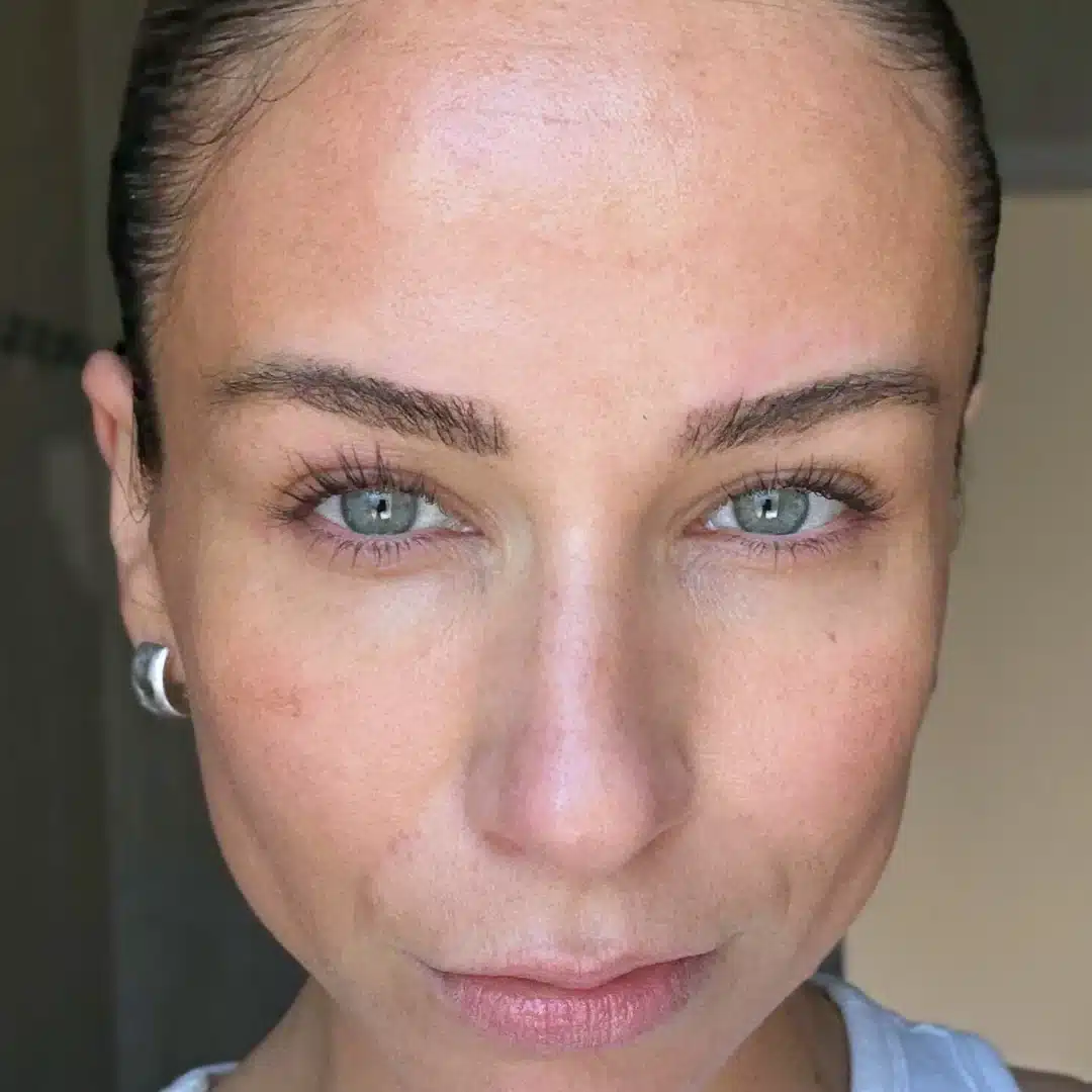 Chanand skincare comparison: after, as published by Chanand