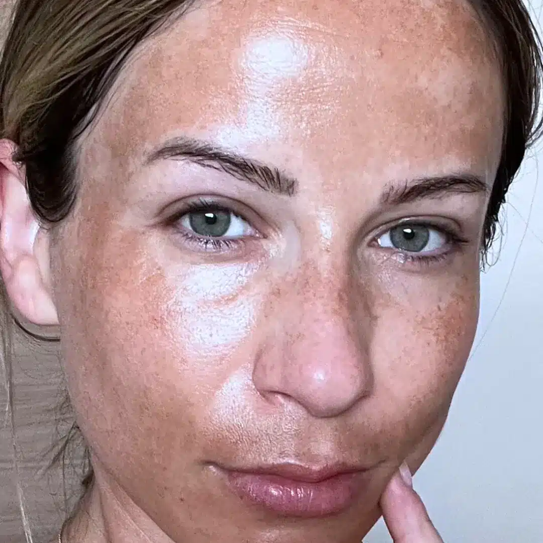 Chanand skincare comparison: before, as published by Chanand