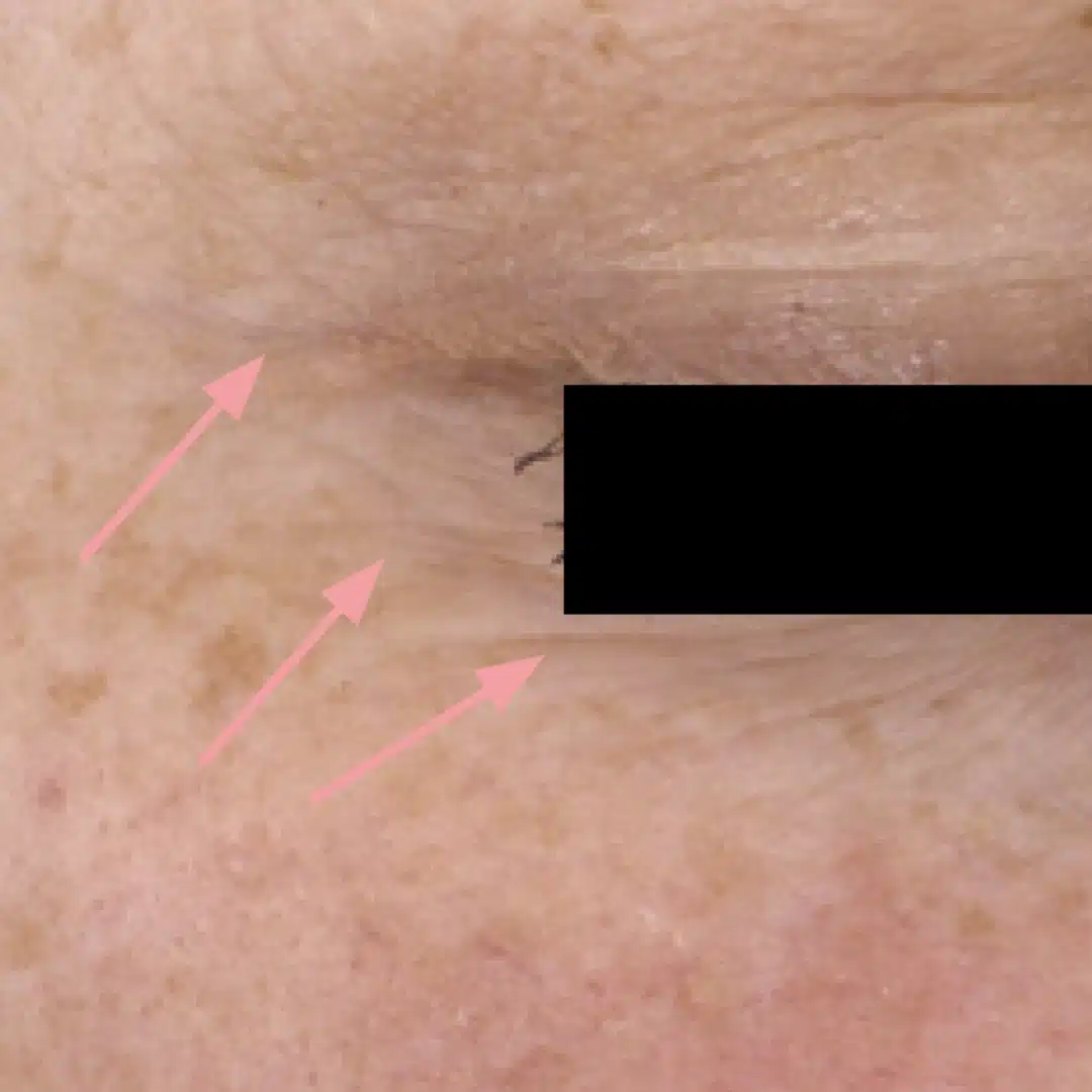 Chanand skincare comparison: after, as published by Chanand