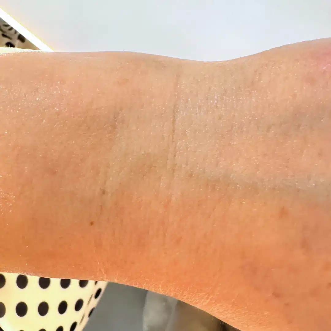 Chanand skincare comparison: after, as published by Chanand