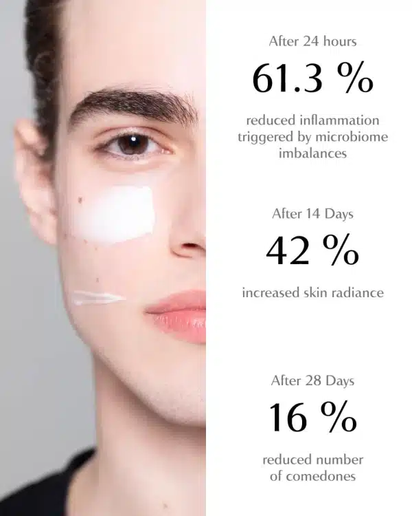 AFC-Acne-Face-Cream-eficacy_Chanand ACNE FACE CREAM