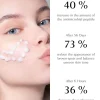 CNS-Concentrate-Niacinamide_Serum_eficacy_chanand CONCENTRATE NIACINAMIDE SERUM