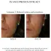 afc-acne-face-cream-chanand-in-vivo-studies ACNE FACE CREAM